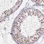 ARMCX5 Antibody in Immunohistochemistry (Paraffin) (IHC (P))