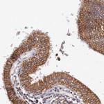 PRICKLE3 Polyclonal Antibody