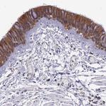 IGBP1 Polyclonal Antibody