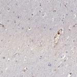 RhoGAP4 Antibody in Immunohistochemistry (IHC)