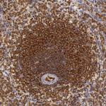 RhoGAP4 Antibody in Immunohistochemistry (IHC)