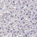 RhoGAP4 Antibody in Immunohistochemistry (IHC)