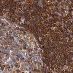 RhoGAP4 Antibody in Immunohistochemistry (IHC)