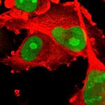 PHF6 Polyclonal Antibody