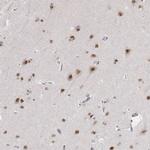PHF6 Antibody in Immunohistochemistry (Paraffin) (IHC (P))