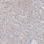 PHF6 Antibody in Immunohistochemistry (Paraffin) (IHC (P))