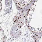 PHF6 Antibody in Immunohistochemistry (Paraffin) (IHC (P))