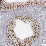 PHF6 Antibody in Immunohistochemistry (IHC)