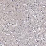 PHF6 Antibody in Immunohistochemistry (IHC)