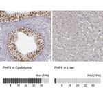 PHF6 Antibody
