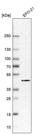 PHF6 Antibody in Western Blot (WB)