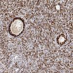 PHF6 Antibody in Immunohistochemistry (IHC)