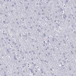 Cystatin A Antibody in Immunohistochemistry (Paraffin) (IHC (P))