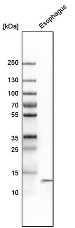 Cystatin A Antibody in Western Blot (WB)