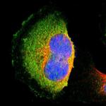 TRMT2A Antibody in Immunocytochemistry (ICC/IF)