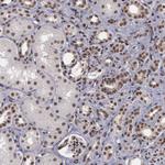 TRMT2A Antibody in Immunohistochemistry (Paraffin) (IHC (P))