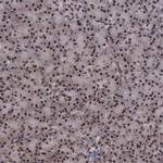TRMT2A Antibody in Immunohistochemistry (Paraffin) (IHC (P))
