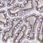 TRMT2A Antibody in Immunohistochemistry (Paraffin) (IHC (P))
