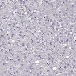 NPTXR Antibody in Immunohistochemistry (Paraffin) (IHC (P))