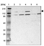 PHKA1 Antibody in Western Blot (WB)