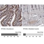 RTCB Polyclonal Antibody