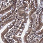 RTCB Antibody in Immunohistochemistry (IHC)