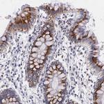 ICK Polyclonal Antibody