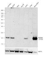 RAB39B Antibody in Western Blot (WB)
