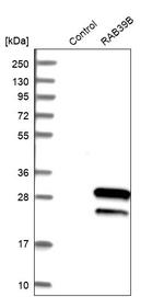 RAB39B Antibody in Western Blot (WB)