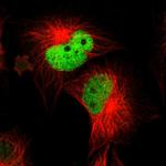 WDHD1 Polyclonal Antibody