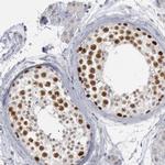 WDHD1 Antibody in Immunohistochemistry (IHC)
