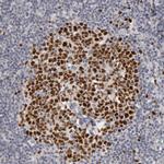WDHD1 Antibody in Immunohistochemistry (IHC)