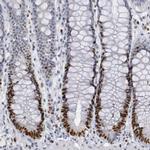 WDHD1 Antibody in Immunohistochemistry (IHC)