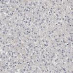 WDHD1 Antibody in Immunohistochemistry (IHC)