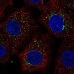 PTGR2 Polyclonal Antibody