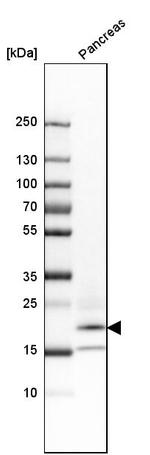 RNase1 Antibody in Western Blot (WB)