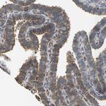 VCPKMT Antibody in Immunohistochemistry (Paraffin) (IHC (P))