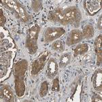 VCPKMT Antibody in Immunohistochemistry (Paraffin) (IHC (P))