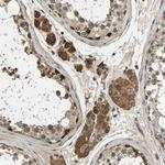 VCPKMT Antibody in Immunohistochemistry (Paraffin) (IHC (P))