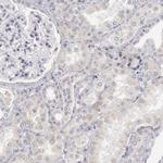 JOSD1 Antibody in Immunohistochemistry (Paraffin) (IHC (P))