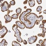 JOSD1 Antibody in Immunohistochemistry (Paraffin) (IHC (P))