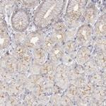 JOSD1 Antibody in Immunohistochemistry (Paraffin) (IHC (P))