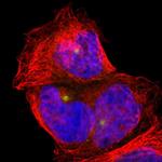 PLA2G6 Polyclonal Antibody