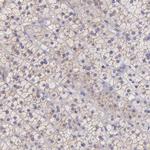 TBC1D22A Antibody in Immunohistochemistry (Paraffin) (IHC (P))