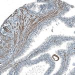 PIGA Polyclonal Antibody