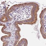 PIGA Antibody in Immunohistochemistry (IHC)