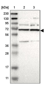 PRPF39 Antibody in Western Blot (WB)