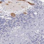 LRFN5 Antibody in Immunohistochemistry (Paraffin) (IHC (P))