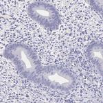 LRFN5 Antibody in Immunohistochemistry (Paraffin) (IHC (P))