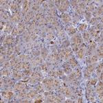 LRFN5 Antibody in Immunohistochemistry (Paraffin) (IHC (P))